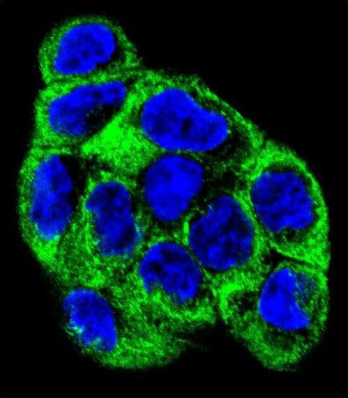 Polyclonal Rabbit anti-Human ATP6V1B1 Antibody (aa284-310, IHC, IF, WB)
