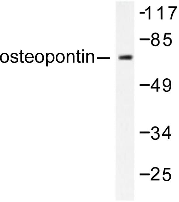 Polyclonal Rabbit anti-Human SPP1 / Osteopontin Antibody (Leu285, IHC, WB)