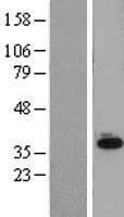 Human SLC25A11 Protein (Over-Expression Lysate Myc-DDK (Flag))