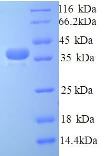 Human TLN1 / Talin 1 Protein (Recombinant His)