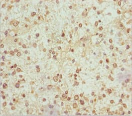 NDUFS1 Antibody