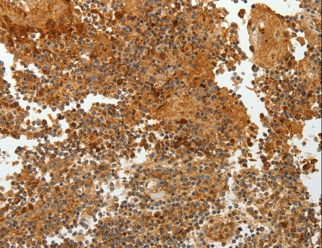 Polyclonal Rabbit anti-Human TFF2 / SP Antibody (IHC)