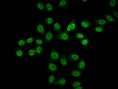 HIST1H2BN Antibody