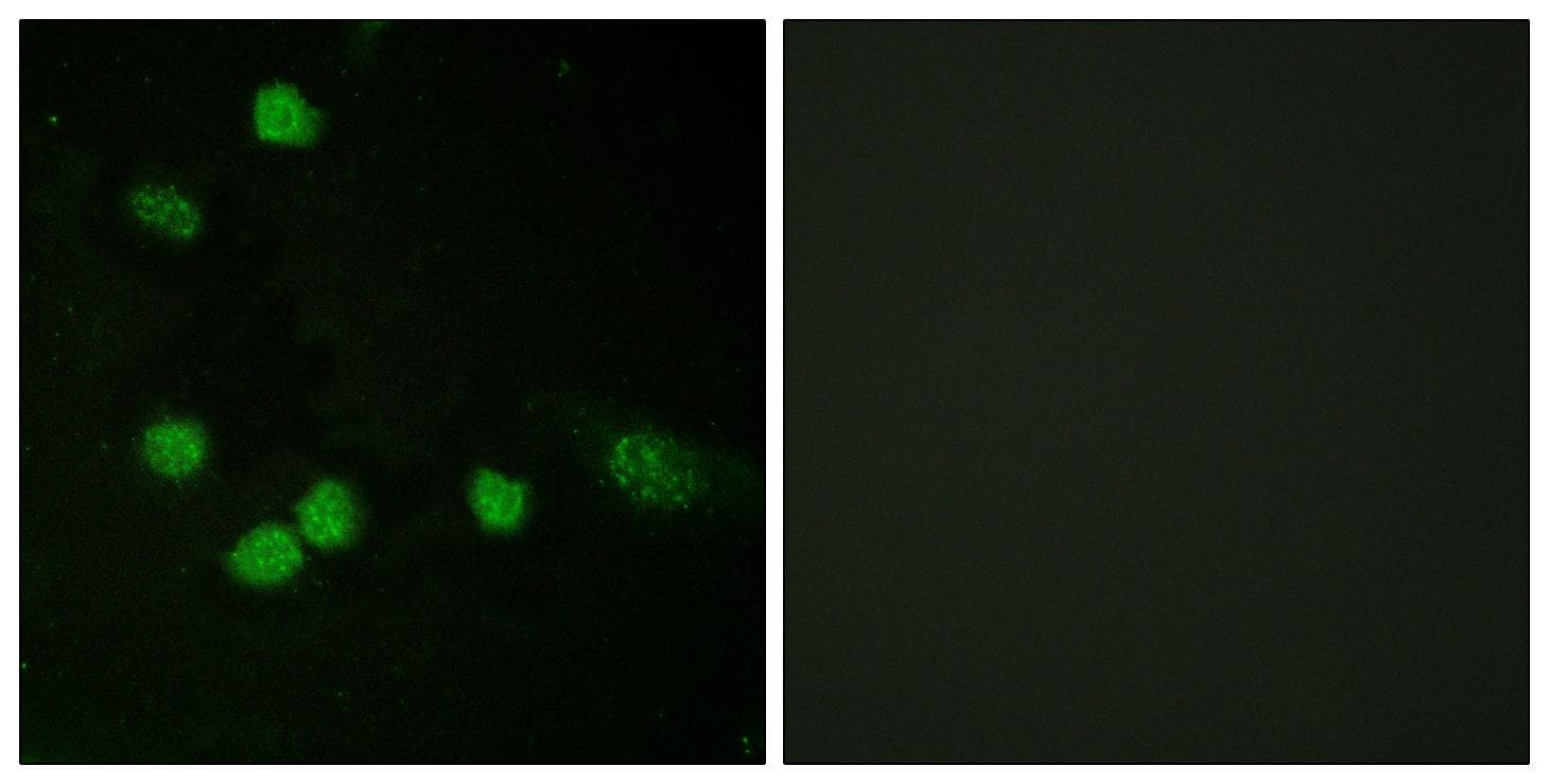 RAF1 / RAF Antibody (p621)