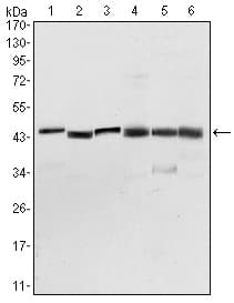 IHC-plus™ PDK1 Antibody (clone 4A11)