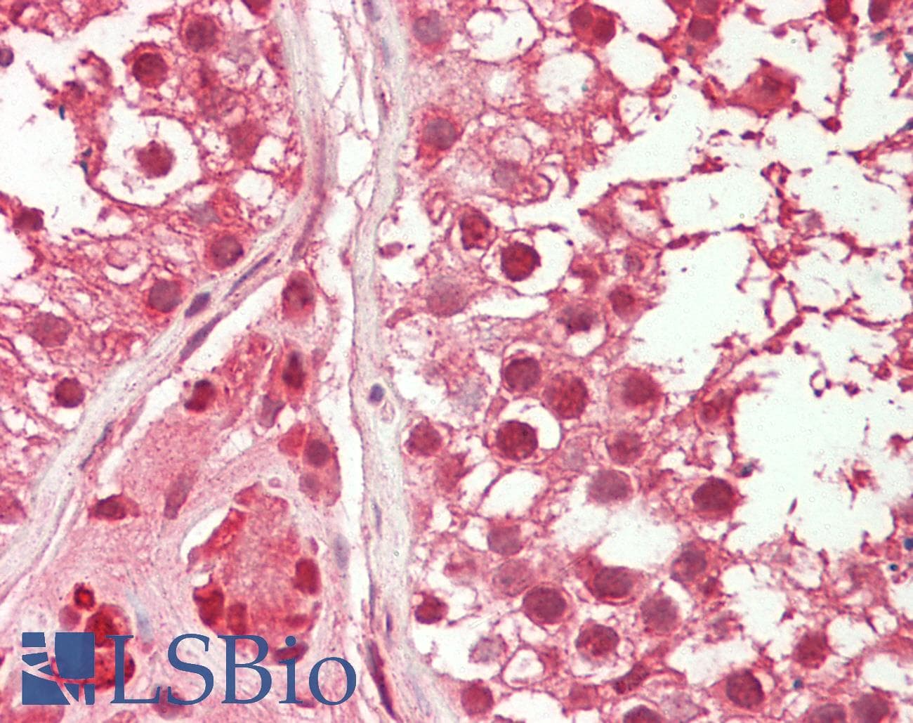 IHC-plus™ HDAC10 Antibody (N-Terminus)