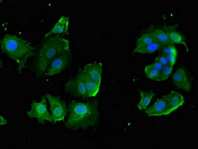 CYP-M / CYP20A1 Antibody