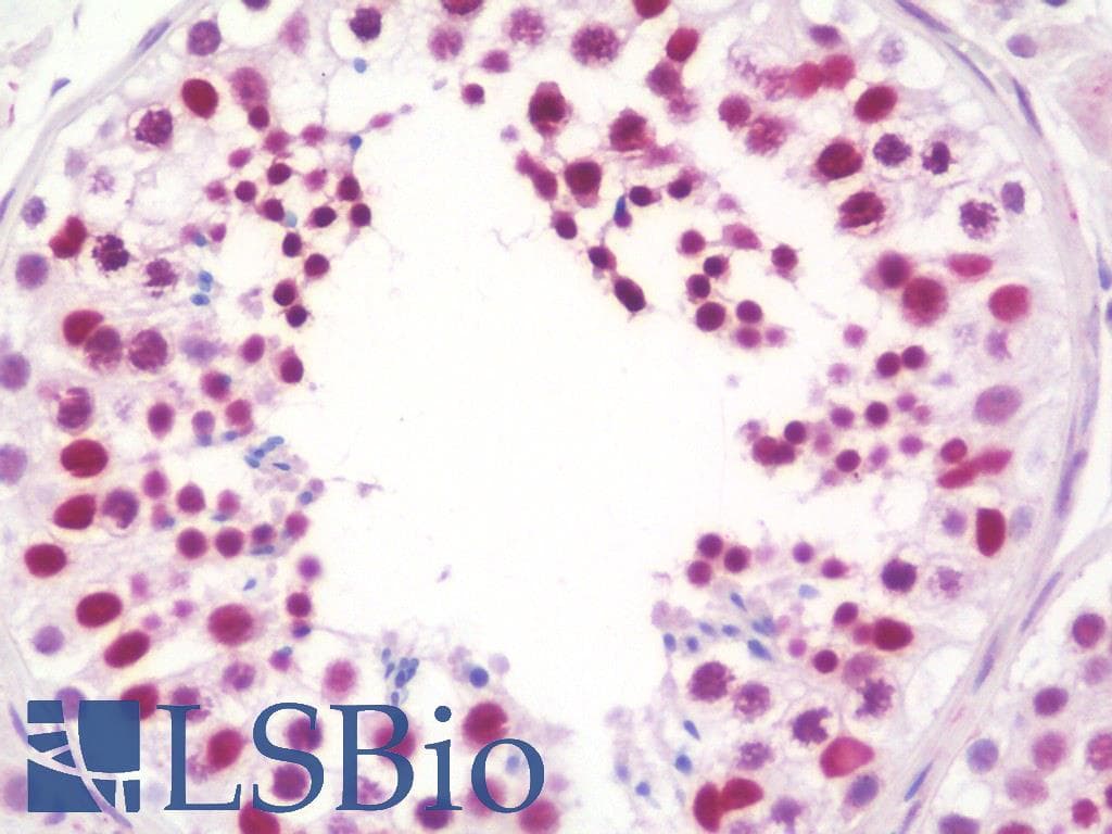 IHC-plus™ SCAF4 Antibody (aa601-650)
