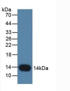 CSTB / Cystatin B / Stefin B Antibody