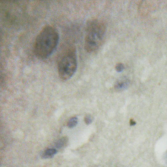 SREBF1 / SREBP-1 Antibody (phospho-Ser439)