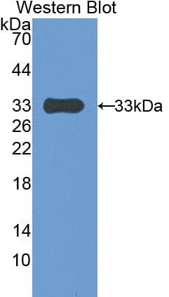 PAPPA / PAPP-A Antibody (aa1270-1558)