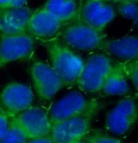 AMOT / Angiomotin Antibody