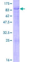 Human TBX5 Protein (Recombinant GST)
