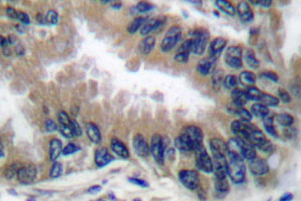Polyclonal Rabbit anti-Human APAF1 / APAF-1 Antibody (His324, IHC, IF, WB)