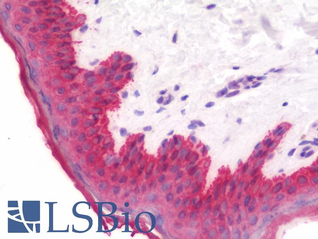 IHC-plus™ Polyclonal Rabbit anti-Human KRT71 / Keratin 71 Antibody (IHC, WB)