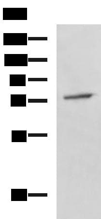 Polyclonal Rabbit anti-Human KIAA1434 protein Antibody (IHC, WB)