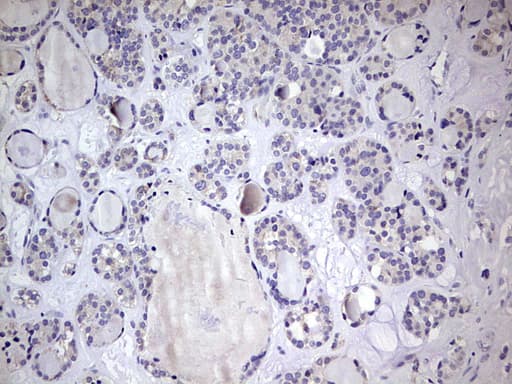 BFSP1 / Filensin Antibody (aa405-665, clone OTI1B9)