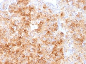 Polyclonal Rabbit anti-Human CHGA / Chromogranin A Antibody (IHC, IF)