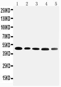 SERPINA6 / CBG Antibody (aa102-120)