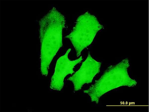 IHC-plus™ Monoclonal Mouse anti-Human TNNI3 / Cardiac Troponin I Antibody (clone 1E7, IHC, IF, WB)