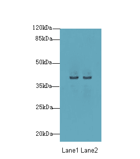 P2Y13 / P2RY13 Antibody