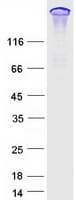 Human ARHGEF11 Protein (Recombinant Myc-DDK (Flag))