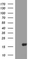 SIVA1 / SIVA Antibody (clone OTI2E4)