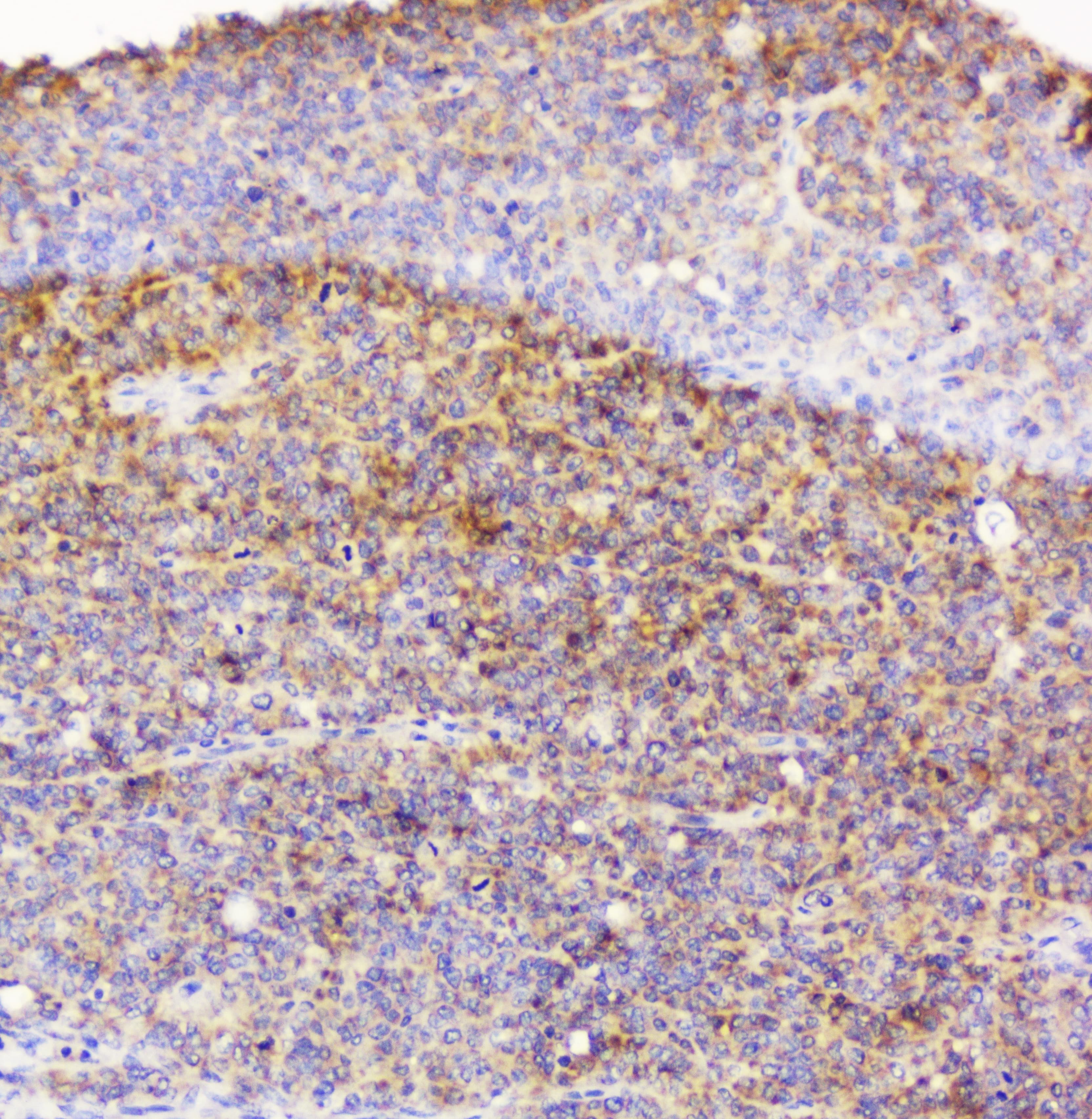 Polyclonal Rabbit anti-Human EML4 Antibody (IHC, WB)
