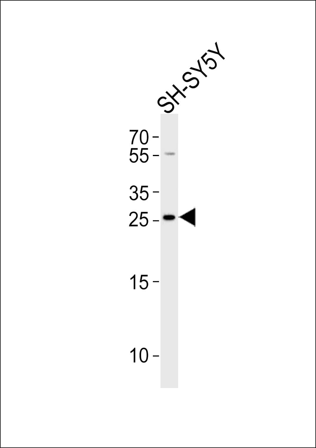 Polyclonal Rabbit anti-Human ZDHHC21 Antibody (aa59-87, IHC, WB)