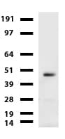 CA12 / Carbonic Anhydrase XII Antibody (clone UMAB121)