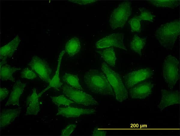 IHC-plus™ HADH Antibody (clone 4B5)