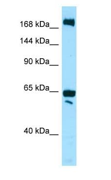 Polyclonal Rabbit anti-Human WNK2 Antibody (aa136-185, WB)