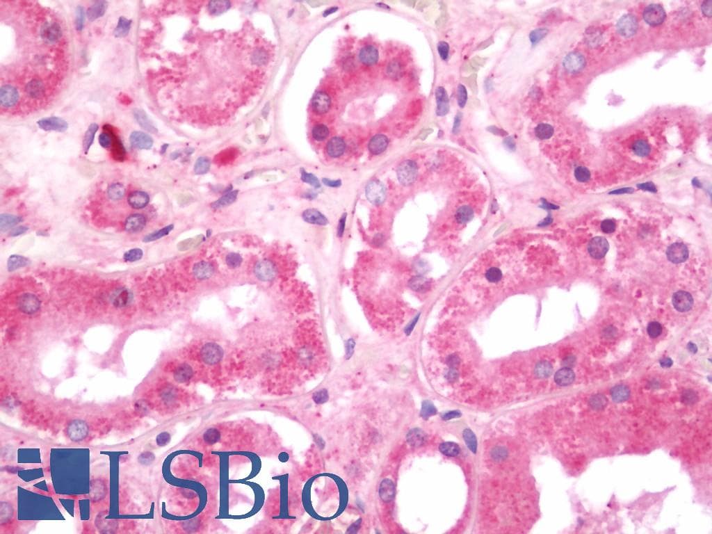 IHC-plus™ Polyclonal Rabbit anti-Human MARK1+2+3+4 Antibody (aa181-230, IHC, IF, WB)