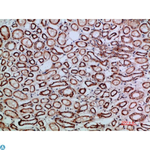 Polyclonal Rabbit anti-Human TGFB2 / TGF Beta2 Antibody (IHC, WB)