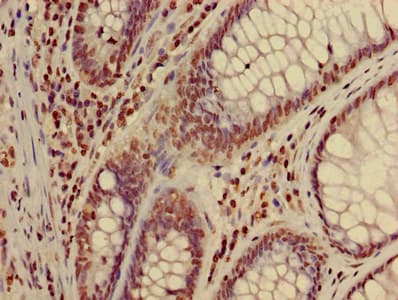 HIST1H3A Antibody