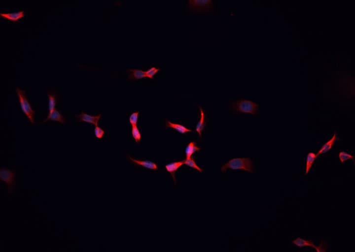 FLT1 / VEGFR1 Antibody