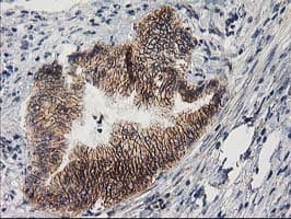 PON1 / ESA Antibody (clone OTI1F7)