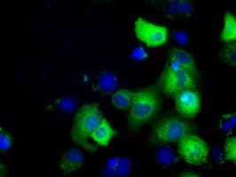 GORASP1 / GRASP65 Antibody (clone OTI5C5)