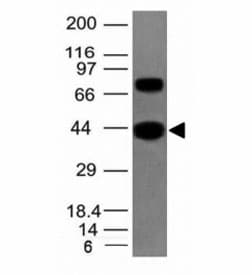 Muscle Actin Antibody (clone MSA/953)