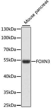 FOXN3 / CHES1 Antibody