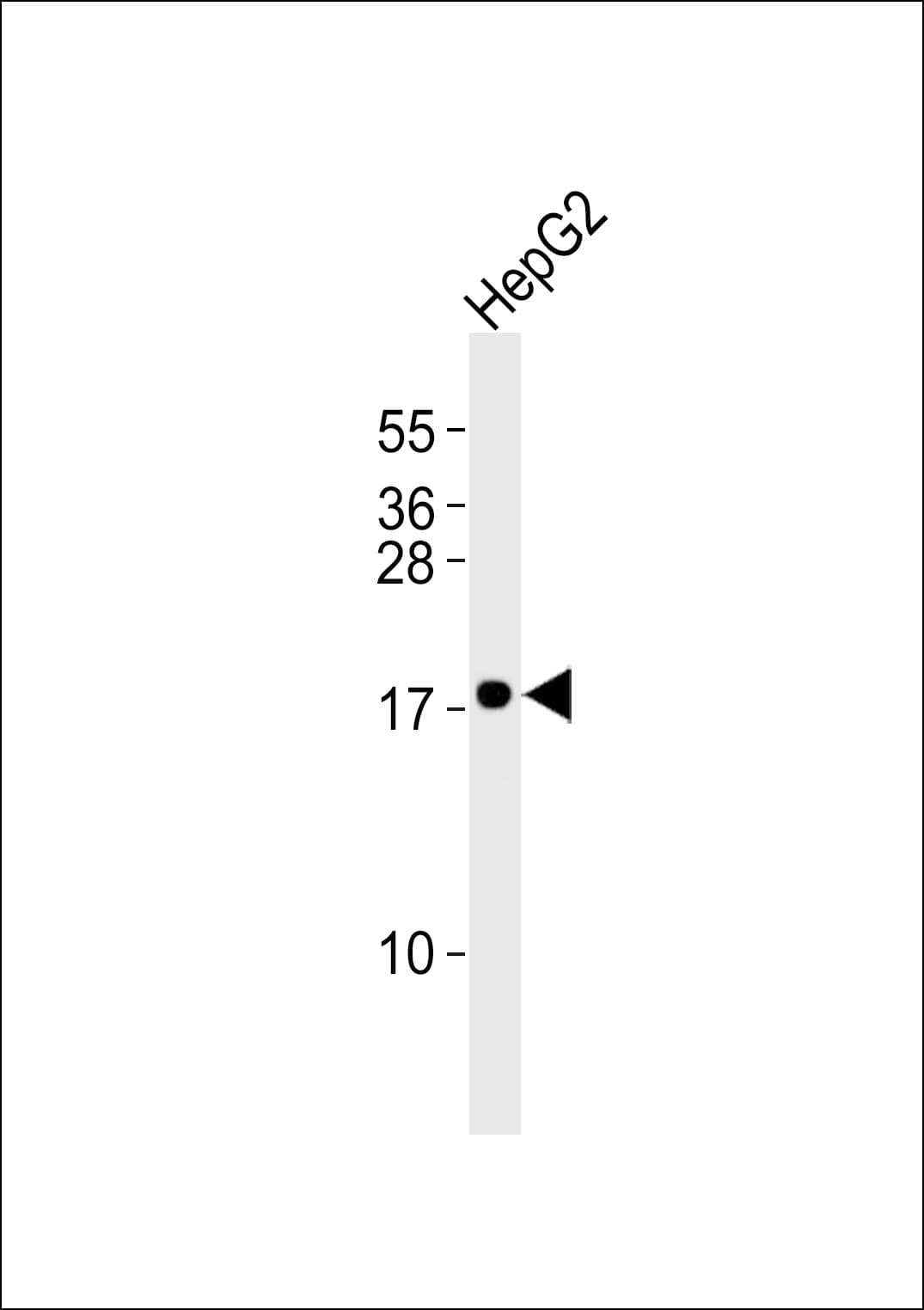 CYB5A / Cytochrome b5 Antibody