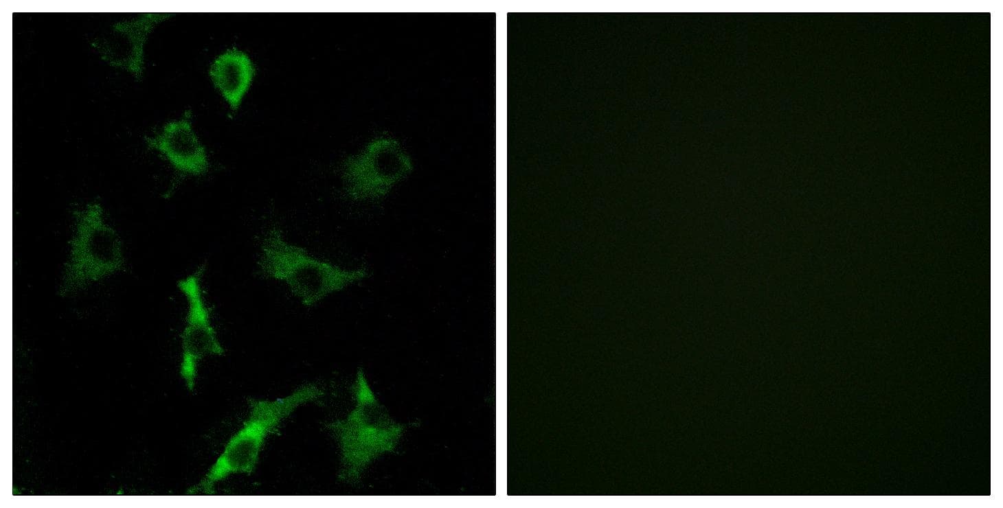 OR5B3 Antibody