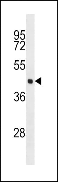 Polyclonal Rabbit anti-Human EIF4A3 Antibody (aa297-325, WB)