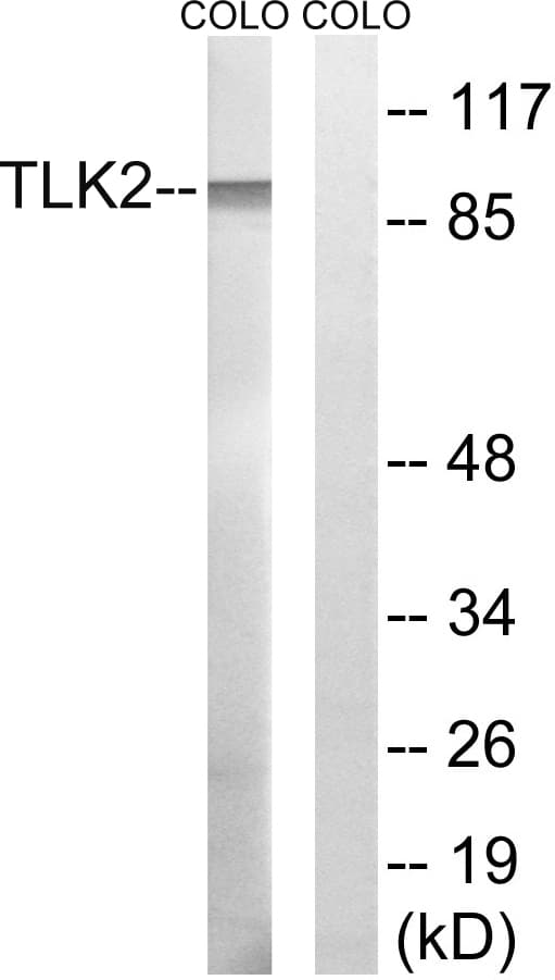 Polyclonal Rabbit anti-Human TLK2 Antibody (aa191-240, WB)