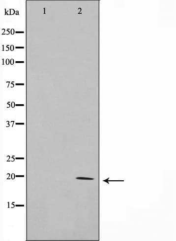 AK6 / Adenylate Kinase 6 Antibody