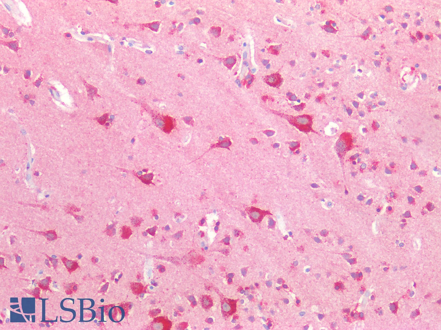 PathPlus™ NPTX1 Antibody