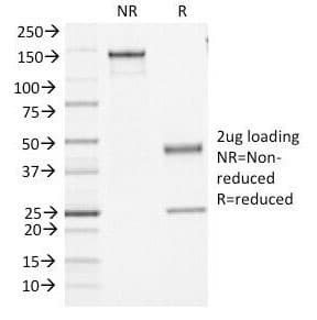 CD45 / LCA Antibody (clone PTPRC/1461)