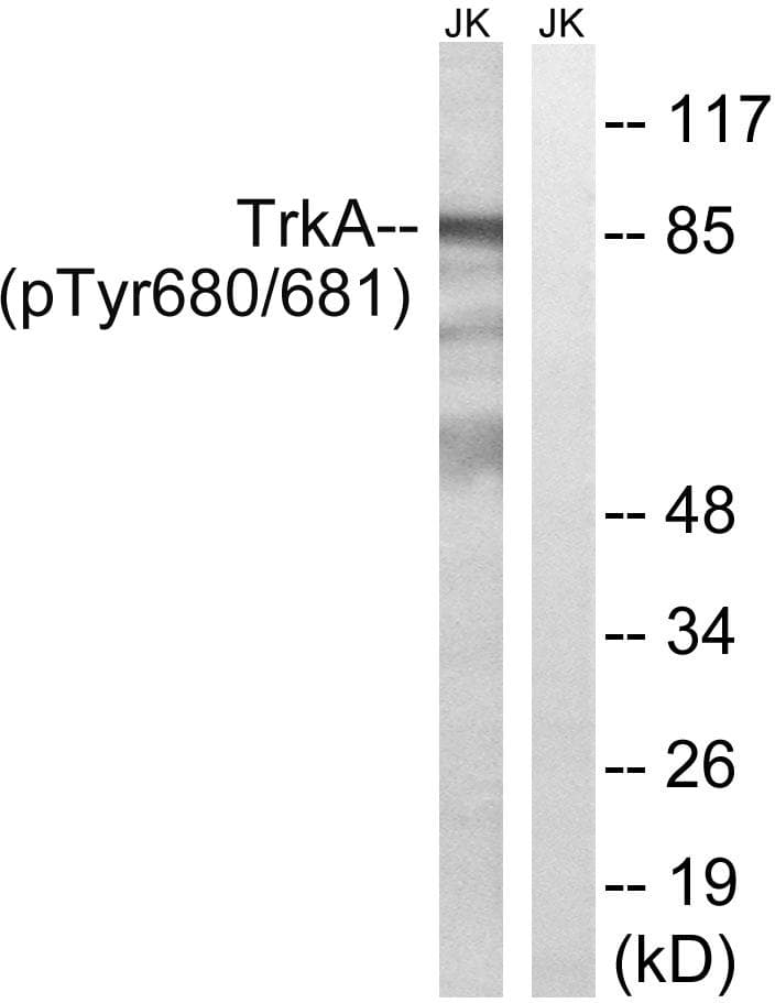 NTRK1 / TrkA Antibody (phospho-Tyr680+Tyr681)