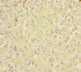 SLC6A12 / BGT-1 Antibody