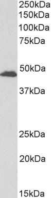 IHC-plus™ GPR17 Antibody (aa353-366)